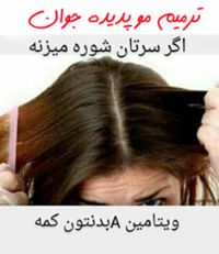 ترمیم و کاشت ابرو ( پدیده جوان)طبیعی